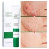 Crema Limpieza Facial Ácido Salicílico
