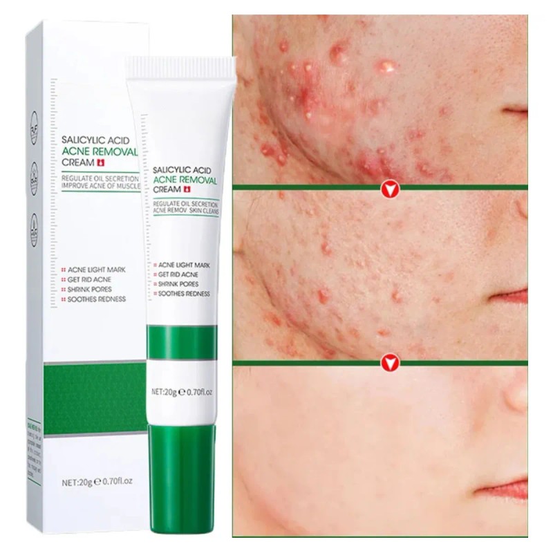 Crema Limpieza Facial Ácido Salicílico