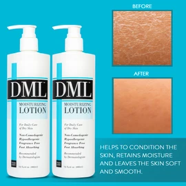 DML Moisturizing Lotion- Hydrating Hand and Body Moisturizer / Hypoallergenic Body Lotion for Dry and Cracked Skin / Gentle, Unscented Moisturizing Lotion Great for Men and Women / 16 oz (Pack of 2)