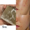 Nature Recipe Deep Cleansing Demodex Soap Demodex Soap Youth Seborrheic Skin Handmade Soap, 100g, 5 Pieces / 네이처레시피 딥클렌징 모낭충 비누 모냥염 비누 청소년 지루성 피부 수제비누, 100g, 5개입