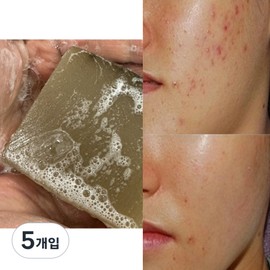 Nature Recipe Deep Cleansing Demodex Soap Demodex Soap Youth Seborrheic Skin Handmade Soap, 100g, 5 Pieces / 네이처레시피 딥클렌징 모낭충 비누 모냥염 비누 청소년 지루성 피부 수제비누, 100g, 5개입