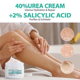 Urea Cream 40 Percent -Urea Foot Cream for Dry Cracked - 40% Urea Cream for Feet - Foot Moisturizer Deep Nourishing - Callus Remover Nourishes Soften for Feet, Knees, Hand 150g