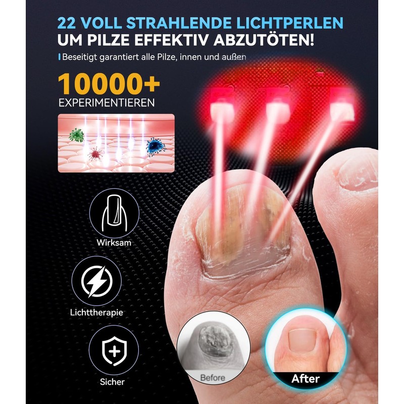Nail pil laser device, 7 days fast acting, with time