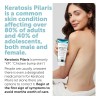 Tratamiento Para La Queratosis Pilaris | Loción Para La Quer