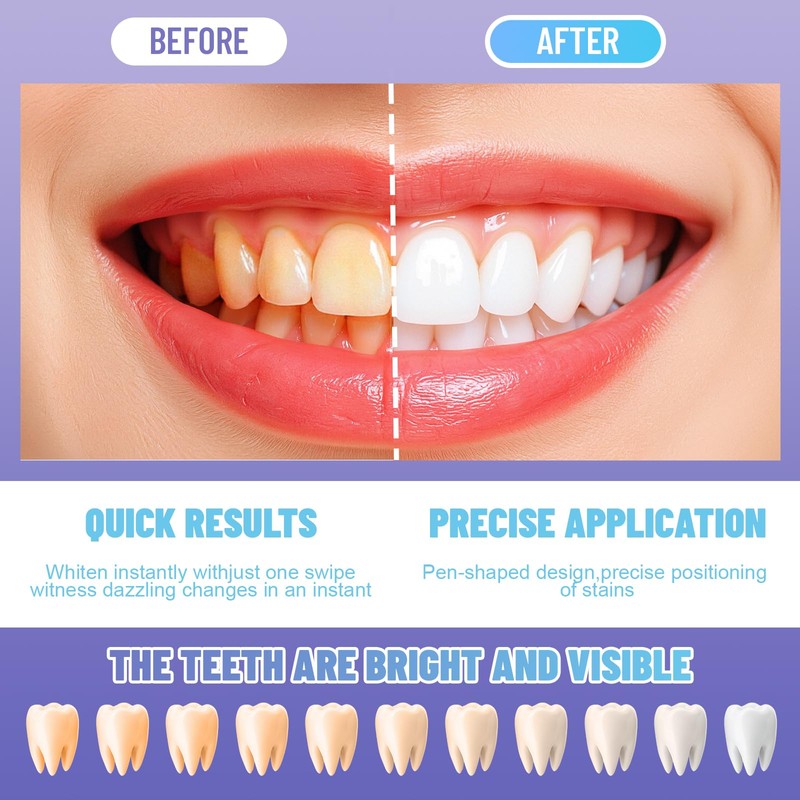 Teeth Whitening Kit, Quickly Whiten Teeth, Effectively Clean Teeth, Daily
