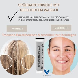 VShower Pro Filter-Duschkopf für hartes Wasser – Hochdruck, Wasser sparend, Chlorentfernung, Wasserenthärtung, 2 Strahlarten, Anti-Verstopfungsdüsen, Schützt Haut & Haare