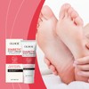 Soft Feet Solution – OUHOE Moisturizing Foot Cream with Aloe
