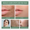 Spots Removal Serum, Niacinamide Serum for Face, Dark Spot Correcting