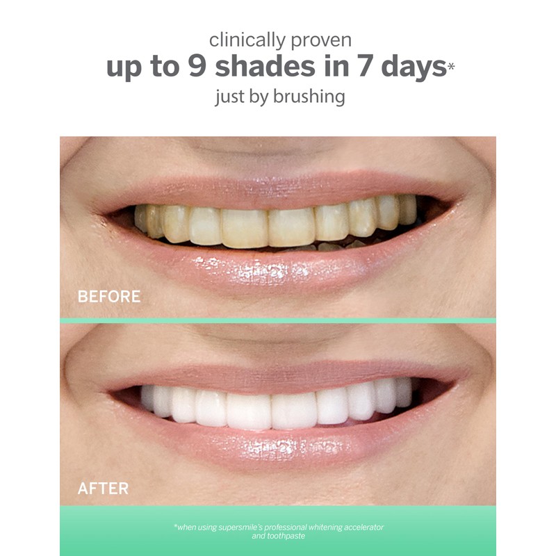 Supersmile Extra White Triple Mint Whitening Toothpaste Pump – Professional