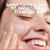 Avène Dermatologist Recommended Sensitive Skin Starter Kit