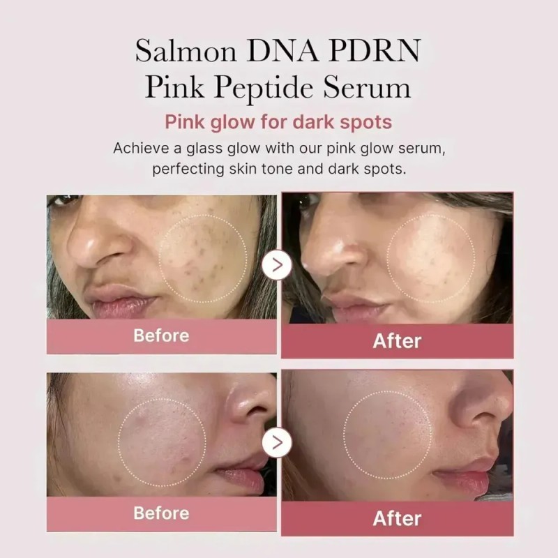 Pornografía De Adn De Salmon Sordo De Peptideo Rosa Medicube