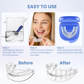 Anti-Snoring Mouth Guard, Adjustable Anti Snoring Devices, Snoring Solution for Men & Women, Snore Stopper, Professional & Reusable Anti-Snore Stopper (Blue, One size)