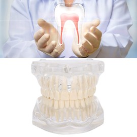 Dental Model, Transparent Acrylic Dental Teeth Model, Simulation Mouth Model, Teeth Typodonts Mode Gingiva Visible Anatomic Demonstration for Teaching, Studying