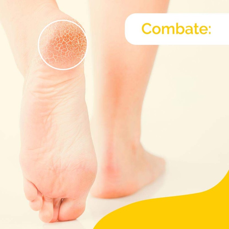 Sch oll Foot Cream for Cracked Heels with Urea and