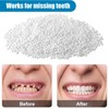 10g Temporäres Zahnreparatur,Kleber Zahnperlen, Für Fehlende Gebrochene Zähne, Abbaubar Selbst