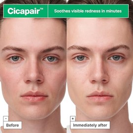 Dr.Jart+ Cicapair Sensitive Skin Serum Korean Face Mask for Redness with Centella Asiatica | Sheet Mask | Korean Skin Care