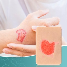 MedEduQuest Granulation Wound Packing Trainer, Palm Sized Wound Simulation Models for Medical Education, Wound Care Demonstrations Tool, 4PCS