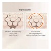 Eliminador De Oscuridad Para Hiperpigmentación Facial, Melas
