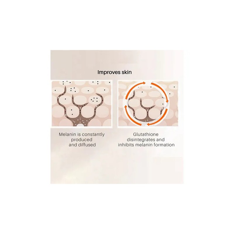 Eliminador De Oscuridad Para Hiperpigmentación Facial, Melas