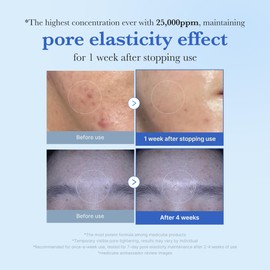 medicube Exosome Shot Zero 25,000 PPM Spicule Facial Serum | Liquid Skin Booster Serum | Exosome, AHA+BHA+PHA | Pore Care, Dead Skin Cells, Skin Texture | Korean Skincare, 0.43 fl.oz