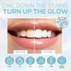 Venus Visage Teeth Whitening Kit - with 4 Carbamide Peroxide