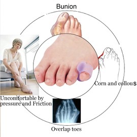 10 piezas de férula de dedo meñique, separadores de dedos de gel, alisador de dedos pequeños para hombres y mujeres que caminan, correr, superponer, corrector de juanetes y alivio de juanetes, pequeño