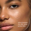 Neutrogena Oil-Free Acne Face Wash, Breakout Prone Skin Facial Cleanser
