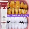 6-1Pack Probiotic Toothpaste SP-6 Whitening Tooth Oral Hygiene Clean Fresh