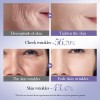 Kit Facial Retinol Antienvejecimiento Vitamina A Bioaqua 6 En 1
