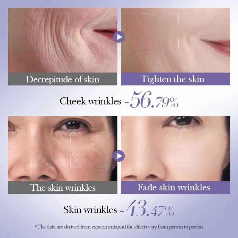 Kit Facial Retinol Antienvejecimiento Vitamina A Bioaqua 6 En 1