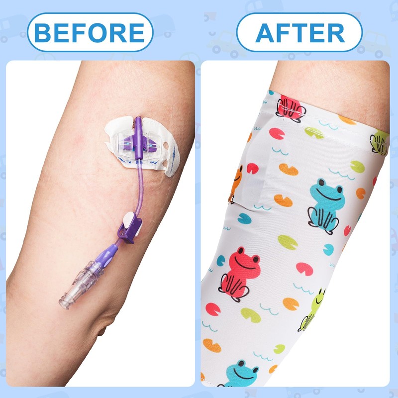 Cuffbow 12 Pcs PICC Line Sleeve Cover for Kids Protector
