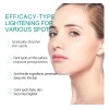 Crema Aclarante Elimina Manchas Piel Exfoliante Facial A