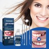 Tooth Repair Kit - Temporary Fake Teeth Replacement Kit with