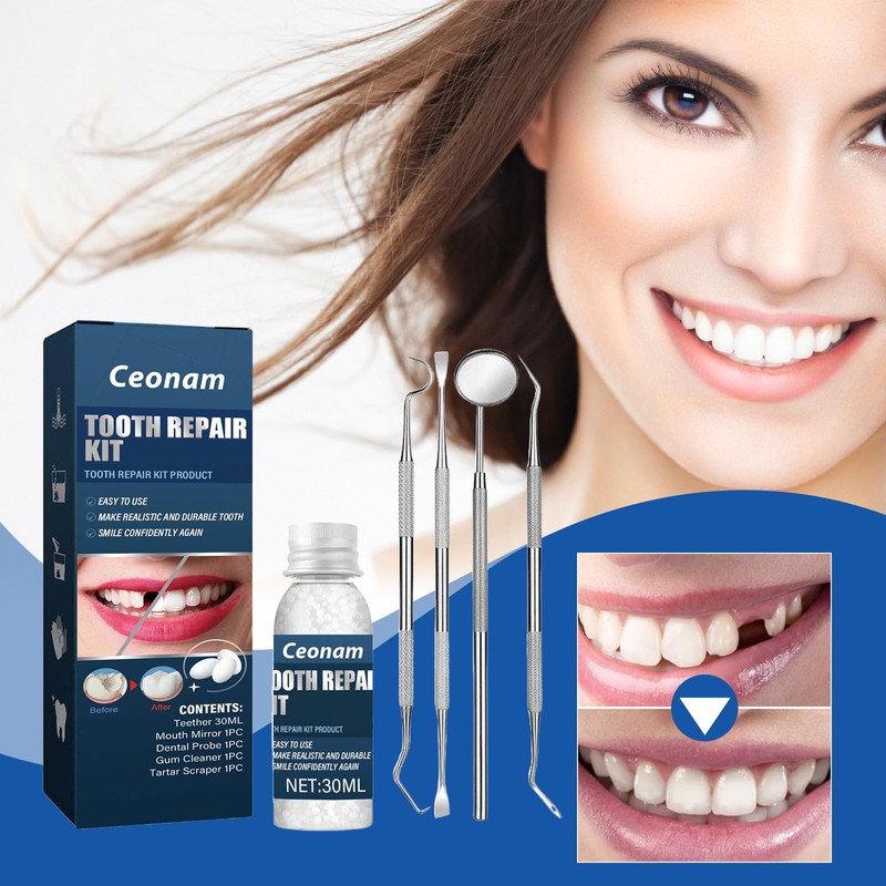 Tooth Repair Kit - Temporary Fake Teeth Replacement Kit with