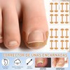 LUSCOR Kit Para Uñas Enterradas,Professional Ingrown Toenail Set,Pegatinas Para Uñas,