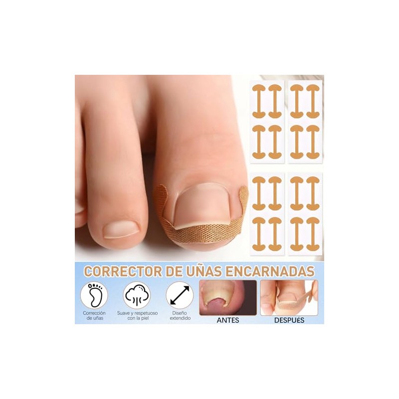 LUSCOR Kit Para Uñas Enterradas,Professional Ingrown Toenail Set,Pegatinas Para Uñas,