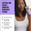 AmLactin KP Bumps Be Gone - Therapeutic Body Cream for