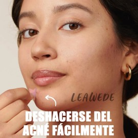 240pzs Mascarillas Estrella Para El Acne Espinillas Granos