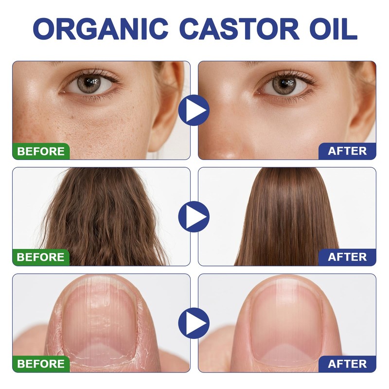 Castor Oil Organic Cold Pressed - Castor Oil Roll On
