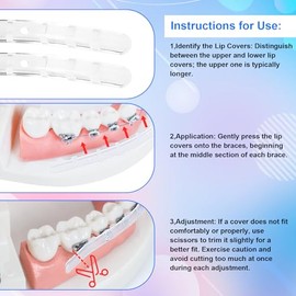 Cubierta de comodidad para brackets, protector labial, protector bucal, almohadilla labial, protector de dientes para brackets, alineador, alternativa a la cera dental, clip duro y rígido, en estuche