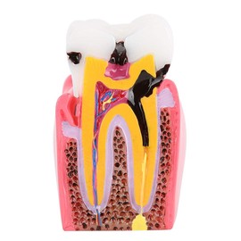 Dental Anatomy Model, Compact Dental Model for Oral Care