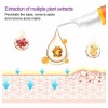 Serum Aclarante Paño Manchas Hiperpigmentacion Pecas 30ml
