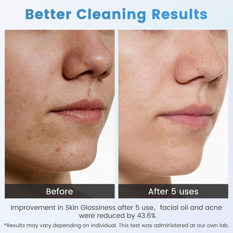 Lrbsule Pore Cleaner – Blackhead & Pimple Remover with 6