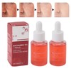 2pcs Dark Spot Correcting Serum with Niacinamide Hyperpigmentation Even Skin