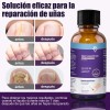 Fungicida Para Uñas Para Uñas Dañadas,rotas Y Decoloradas