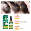 Eelhoe Suero Nutritivo De Jengibre Para Cabello 30