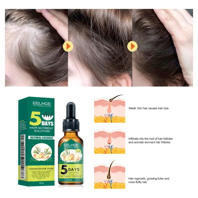 Eelhoe Suero Nutritivo De Jengibre Para Cabello 30