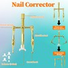Ingrown Toenail Tool Set, Corrector Pedicure, Ingrown Toenails Set, 30