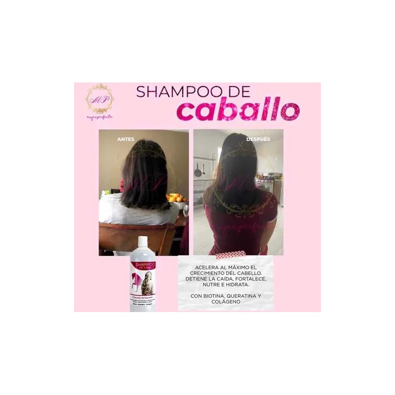 Shampoo De Caballo Detiene La Caída Acelera El Crecimiento