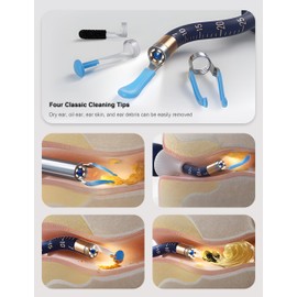 BEBIRD Earsight Plus Ear Wax Removal Tool Camera with HD Visual Otoscope, Smart WiFi Earwax Cleaner Kit, Safe Silicone Flexible Scoops & Tweezers Tools for Adults & Kids (Blue)